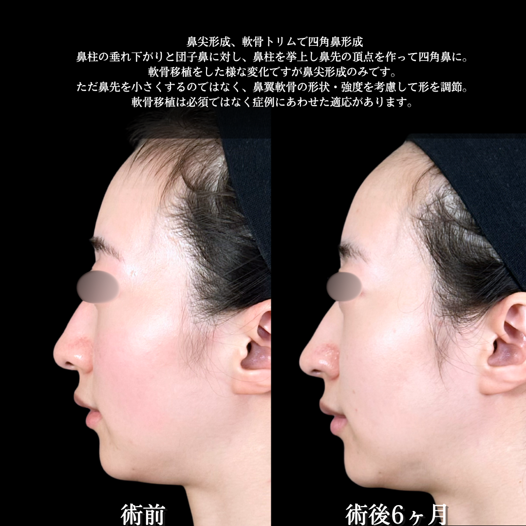 No.18304の症例写真1 No.18304の症例写真1