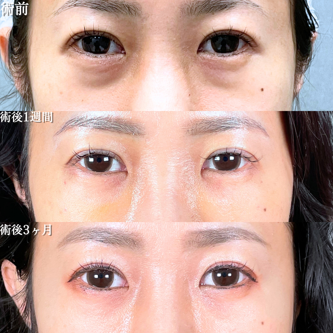 No.18429の症例写真1 No.18429の症例写真1