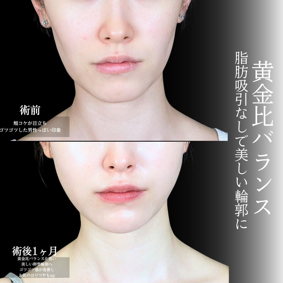 No.18089の症例写真1