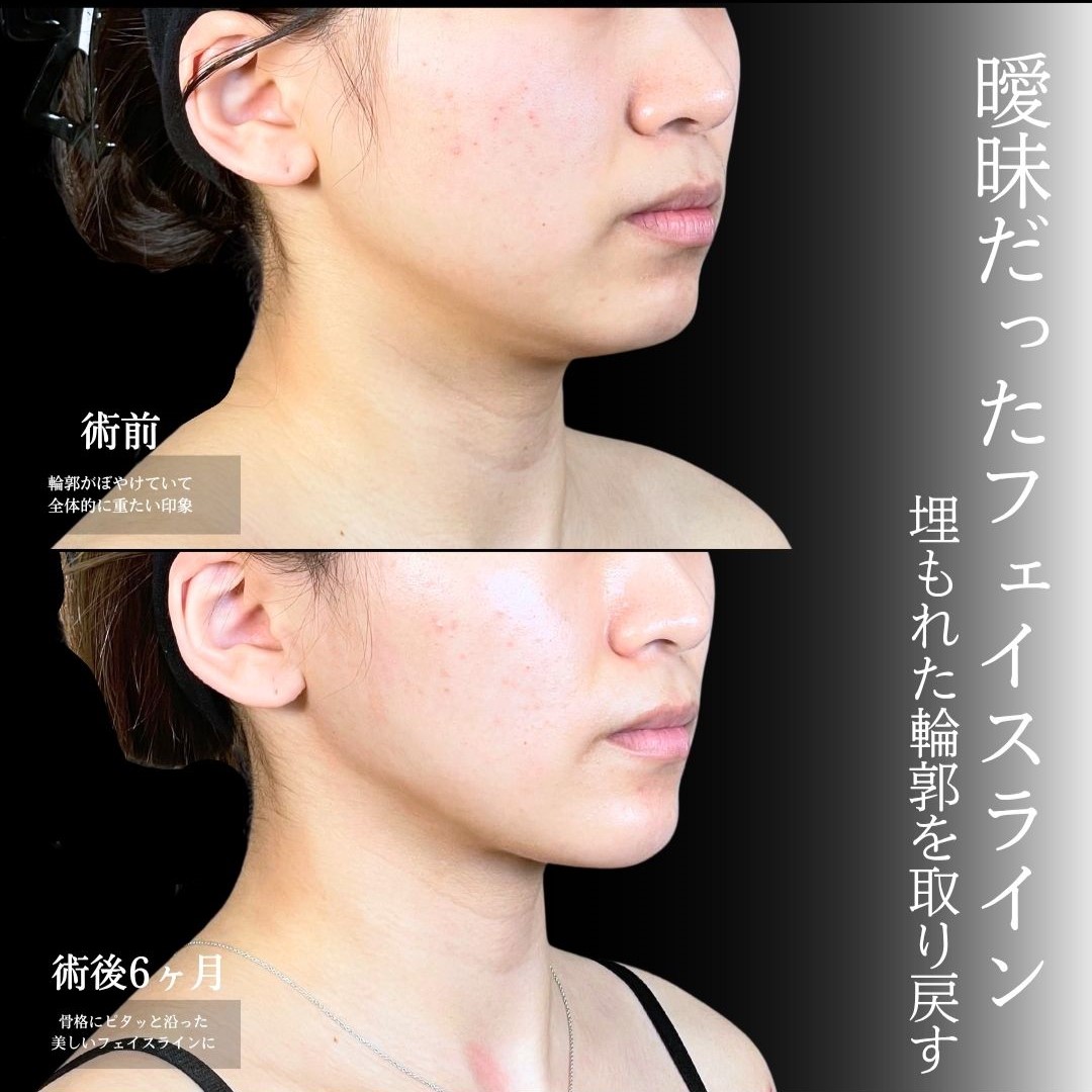 No.18163の症例写真1