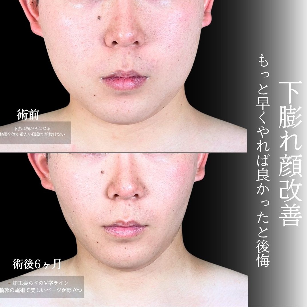 No.17833の症例写真1