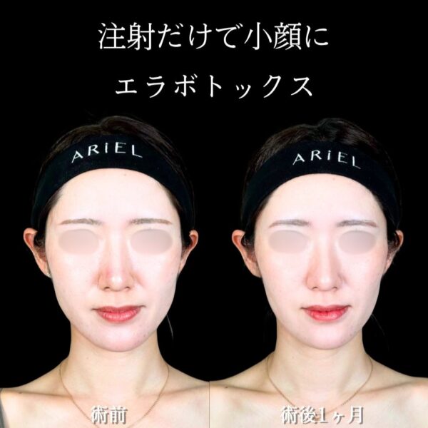 No.17972の症例写真