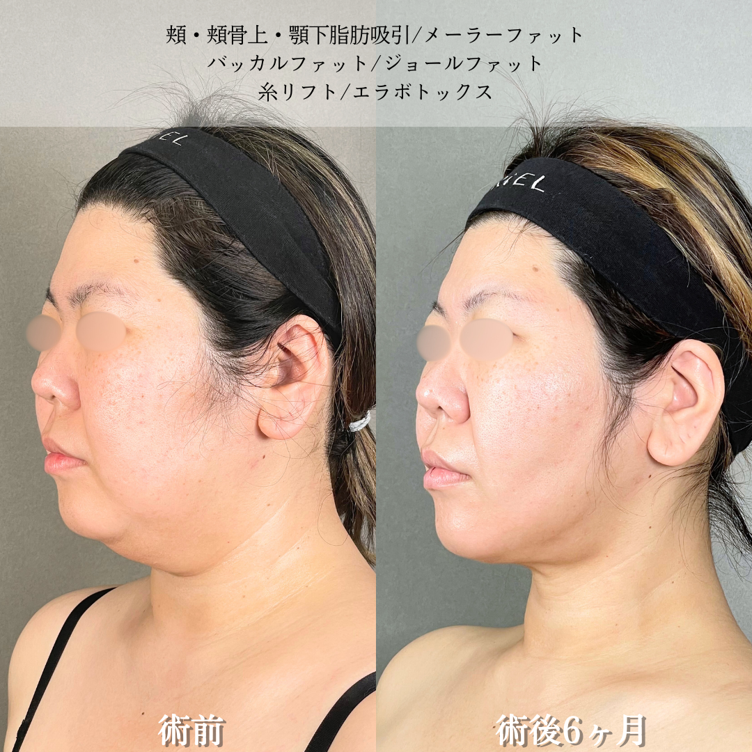 No.18229の症例写真2