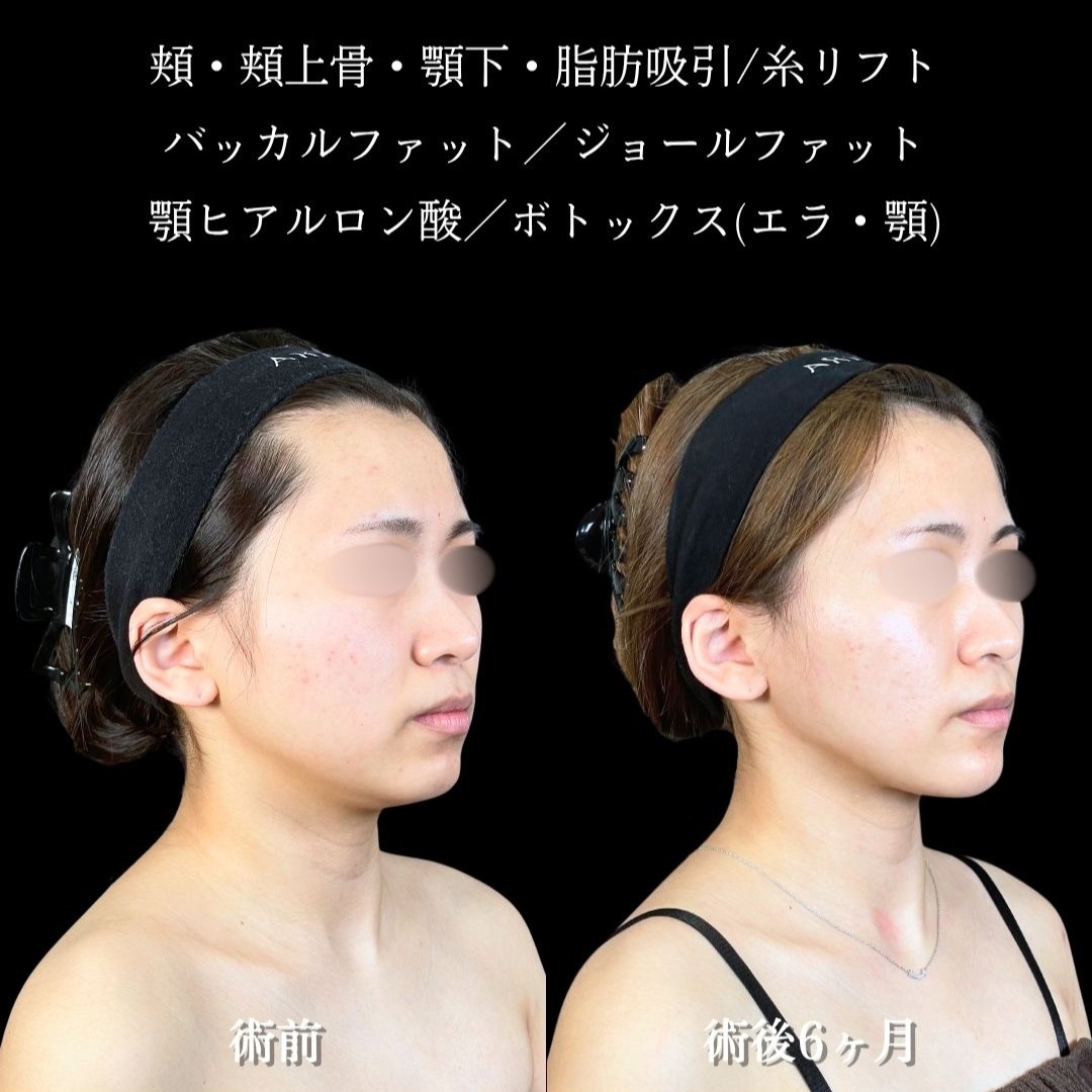 No.18163の症例写真2