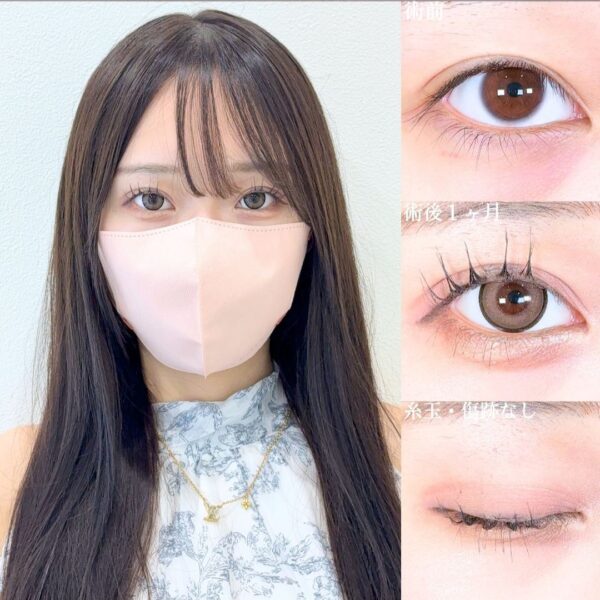 No.18180の症例写真