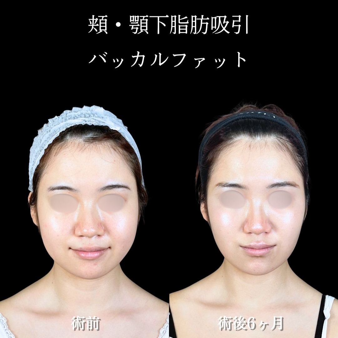 No.18210の症例写真2