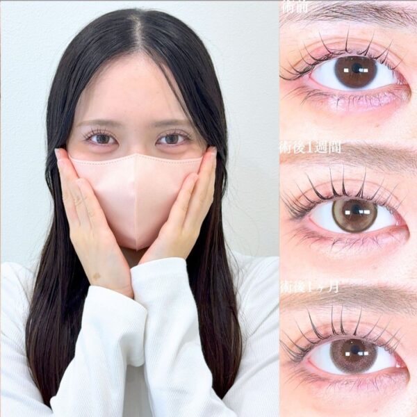 No.18237の症例写真