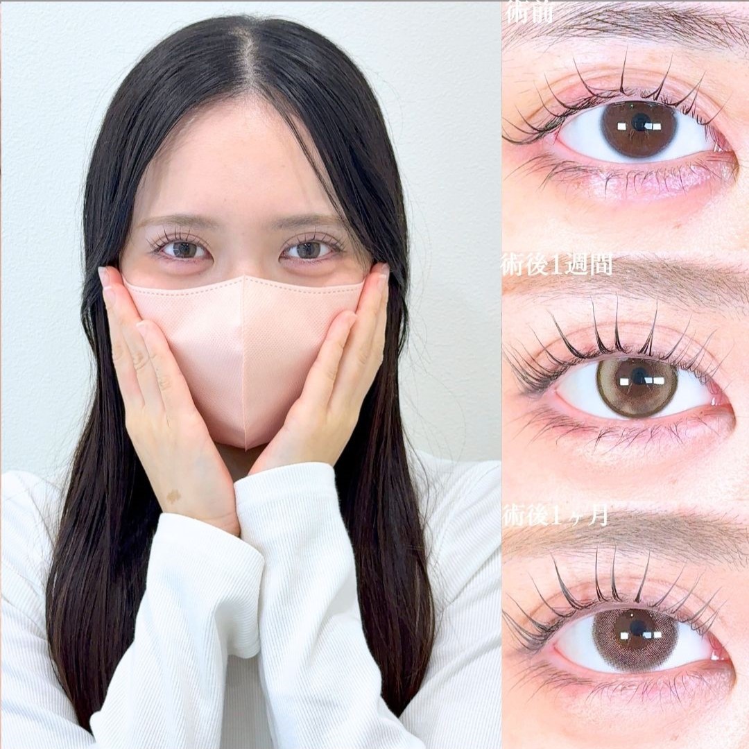 No.18237の症例写真