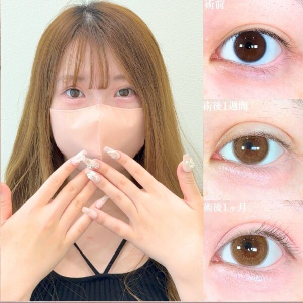 No.18339の症例写真 No.18339の症例写真