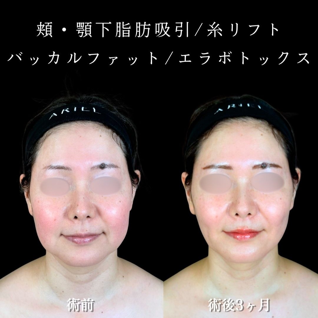 No.18414の症例写真2