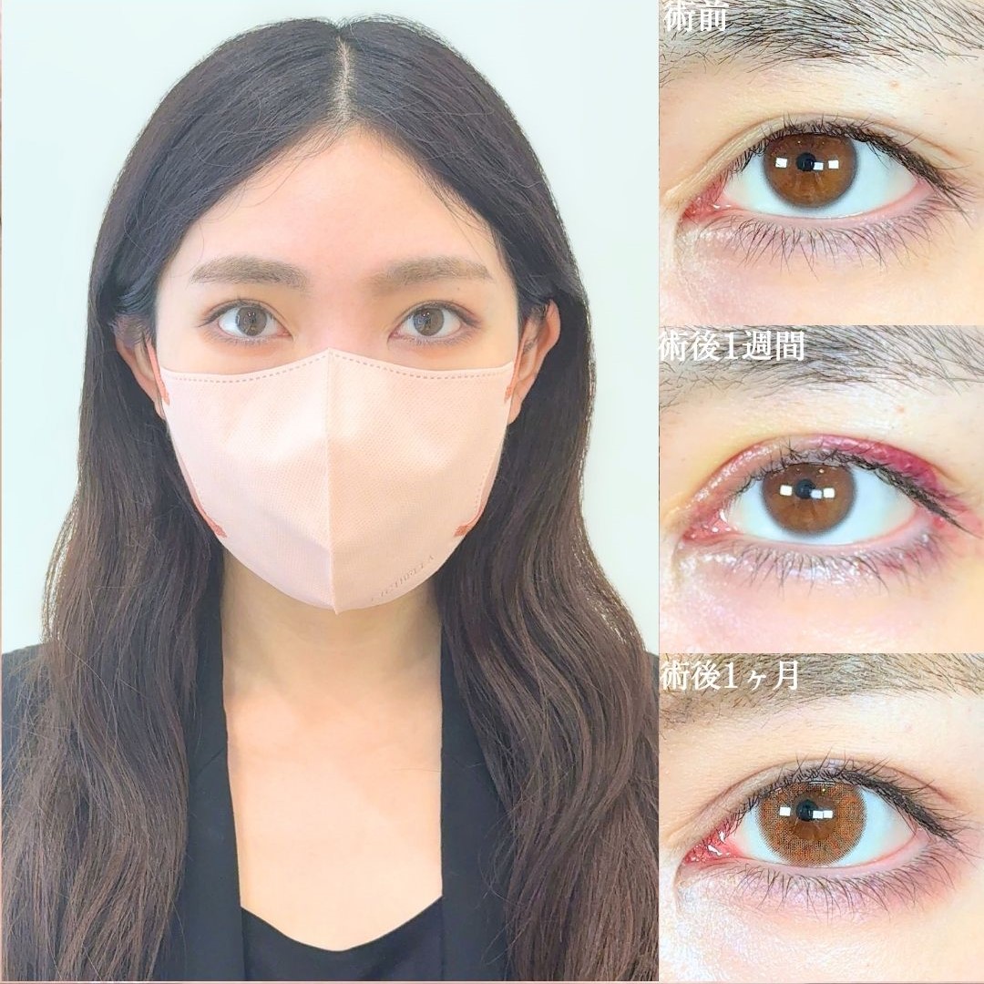 No.18447の症例写真