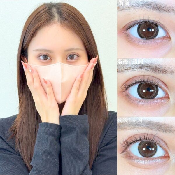 No.18471の症例写真