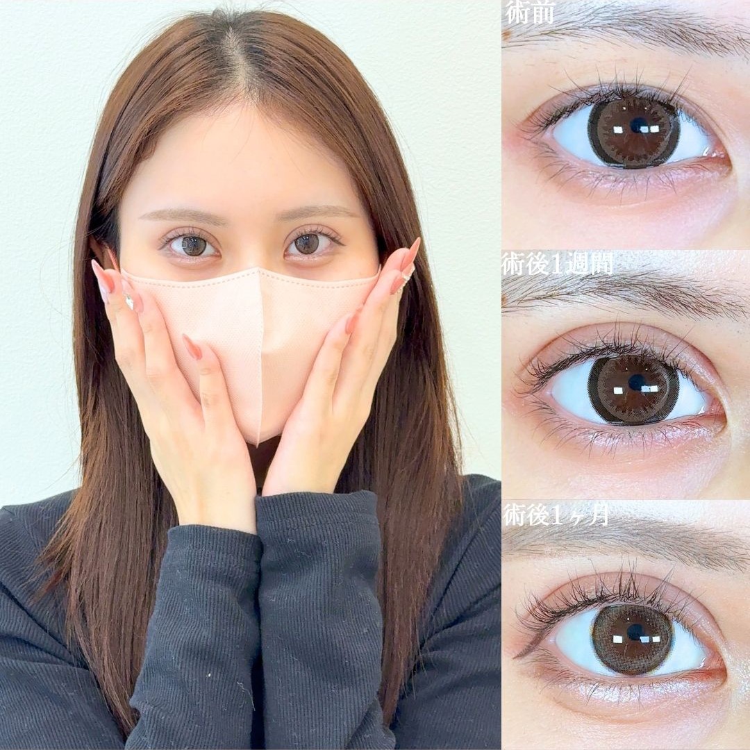 No.18471の症例写真