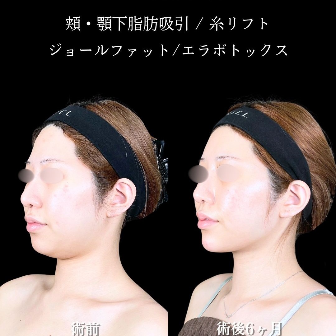 No.17994の症例写真2