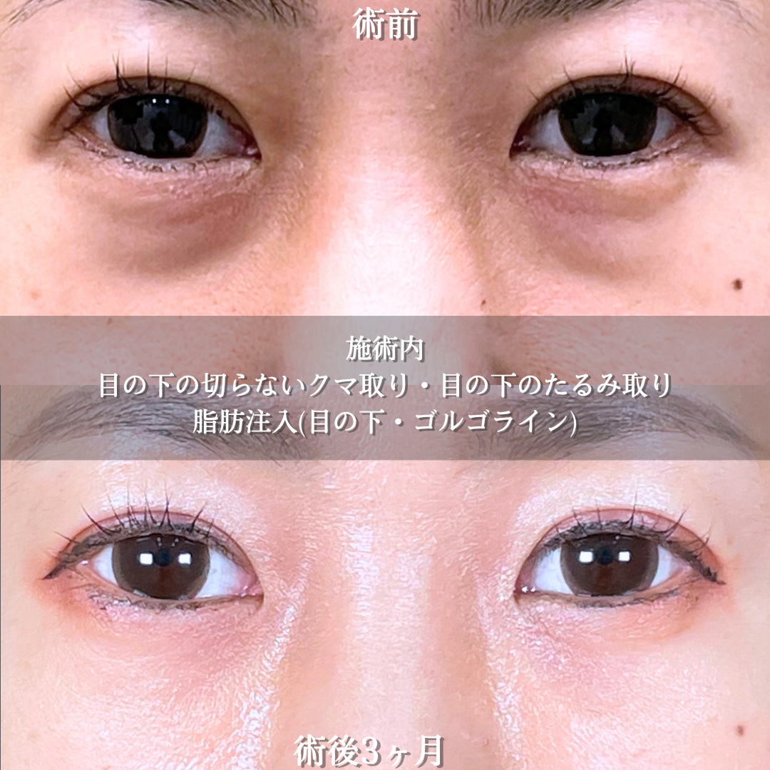 No.18429の症例写真2 No.18429の症例写真2