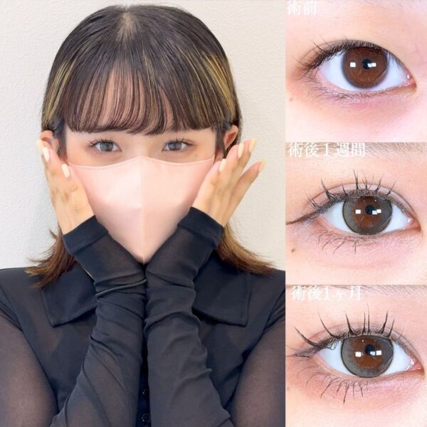 No.18006の症例写真