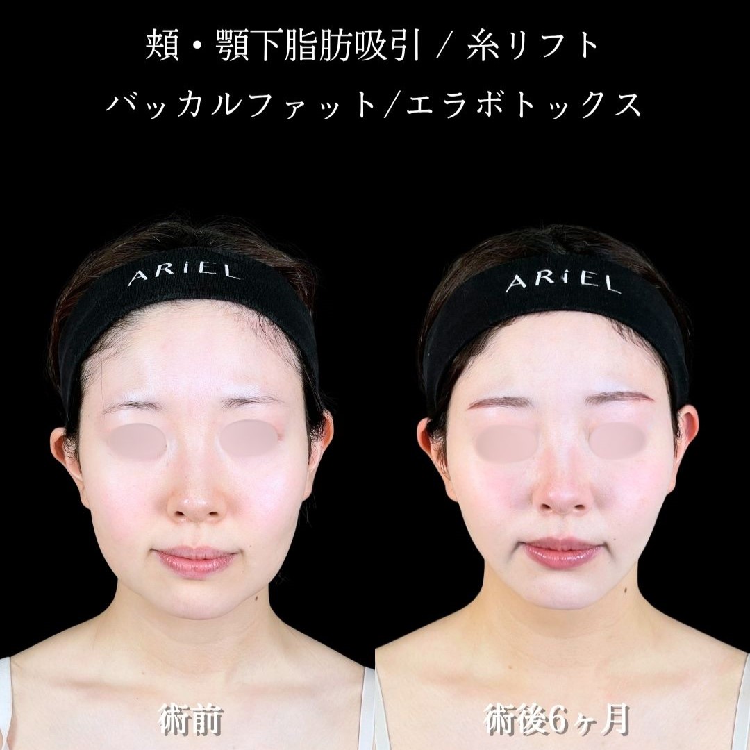 No.18045の症例写真2