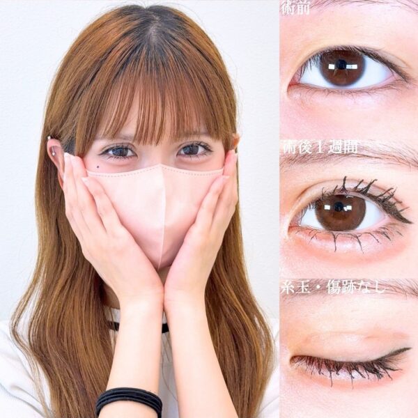 No.18056の症例写真