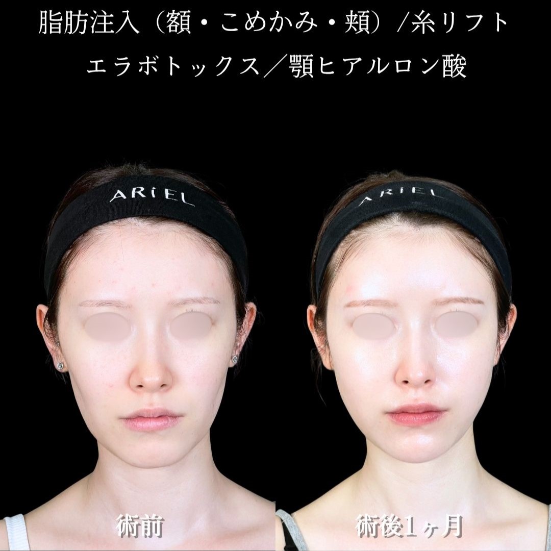 No.18089の症例写真2