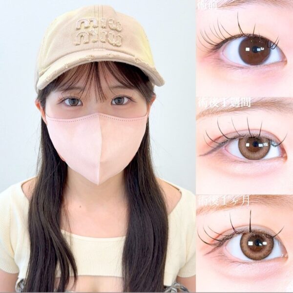 No.18119の症例写真