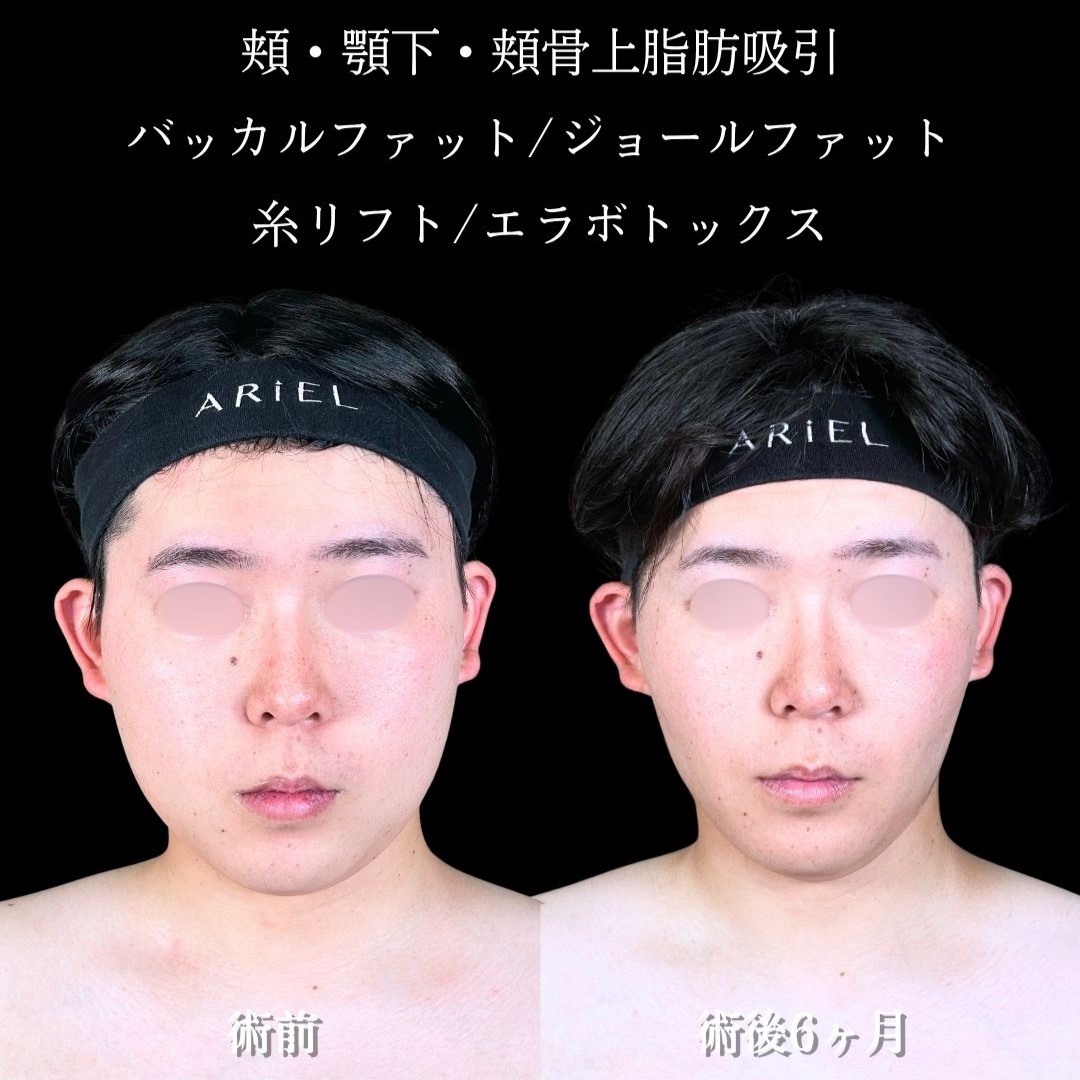No.17833の症例写真2