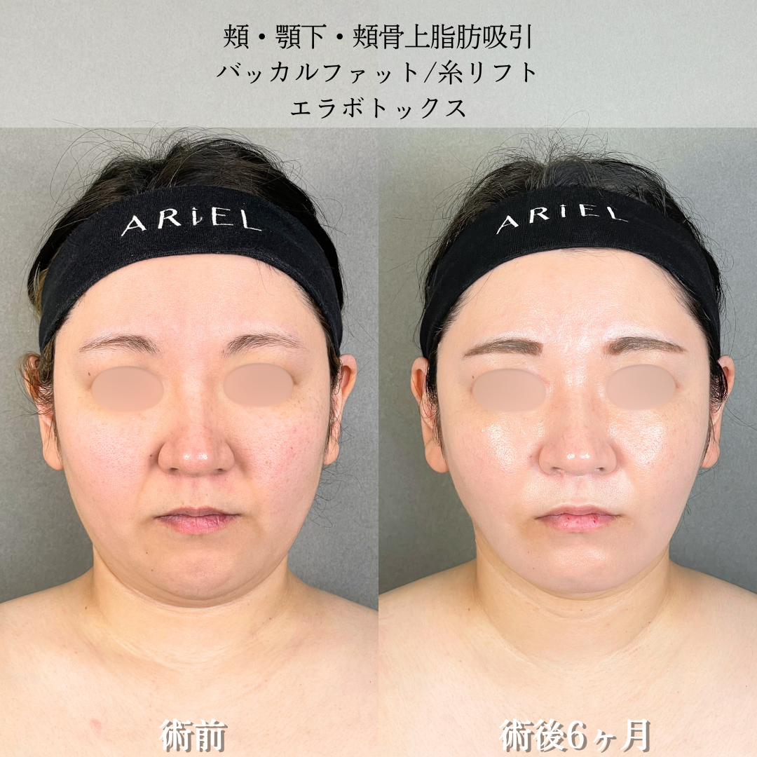 No.18097の症例写真2