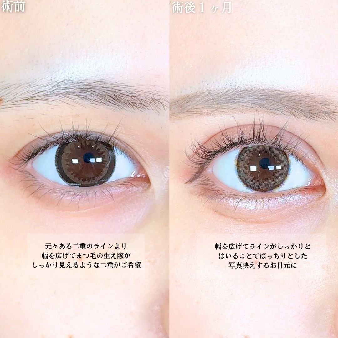 No.18471の症例写真1