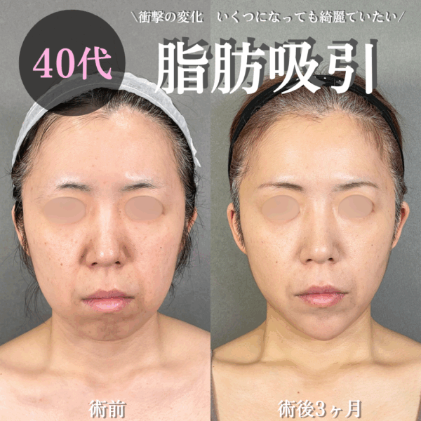 No.18026の症例写真