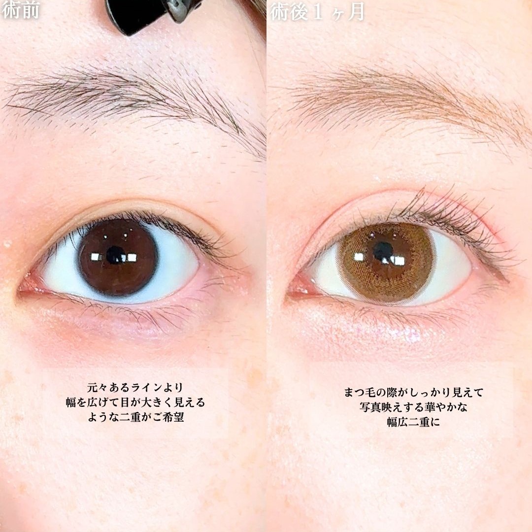 No.18339の症例写真1 No.18339の症例写真1