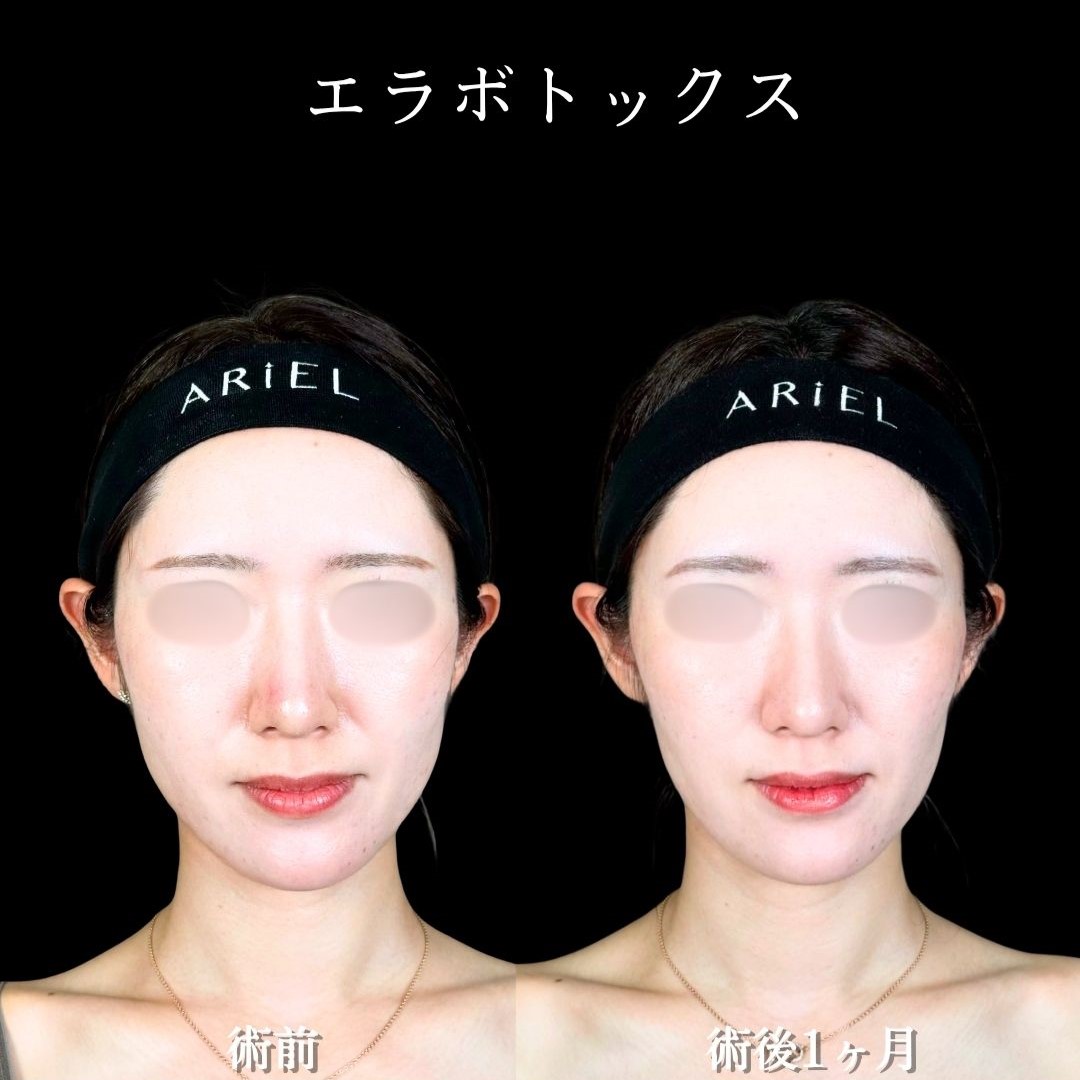 No.17972の症例写真2