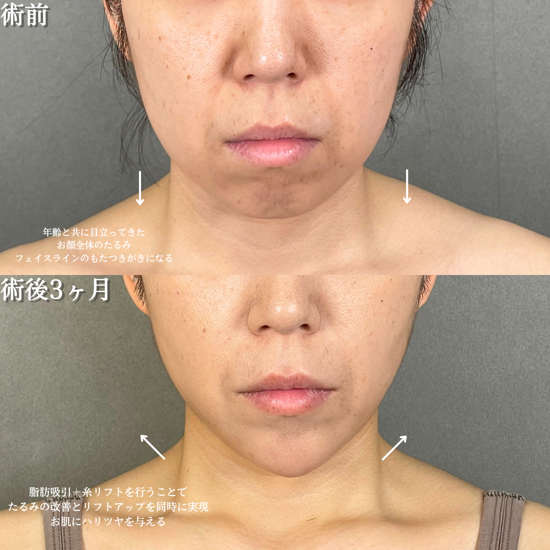 No.18026の症例写真1