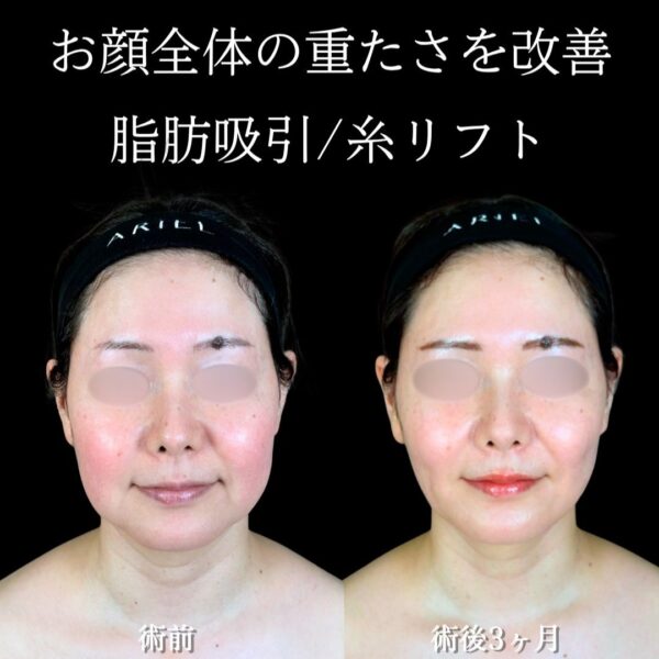 No.18414の症例写真