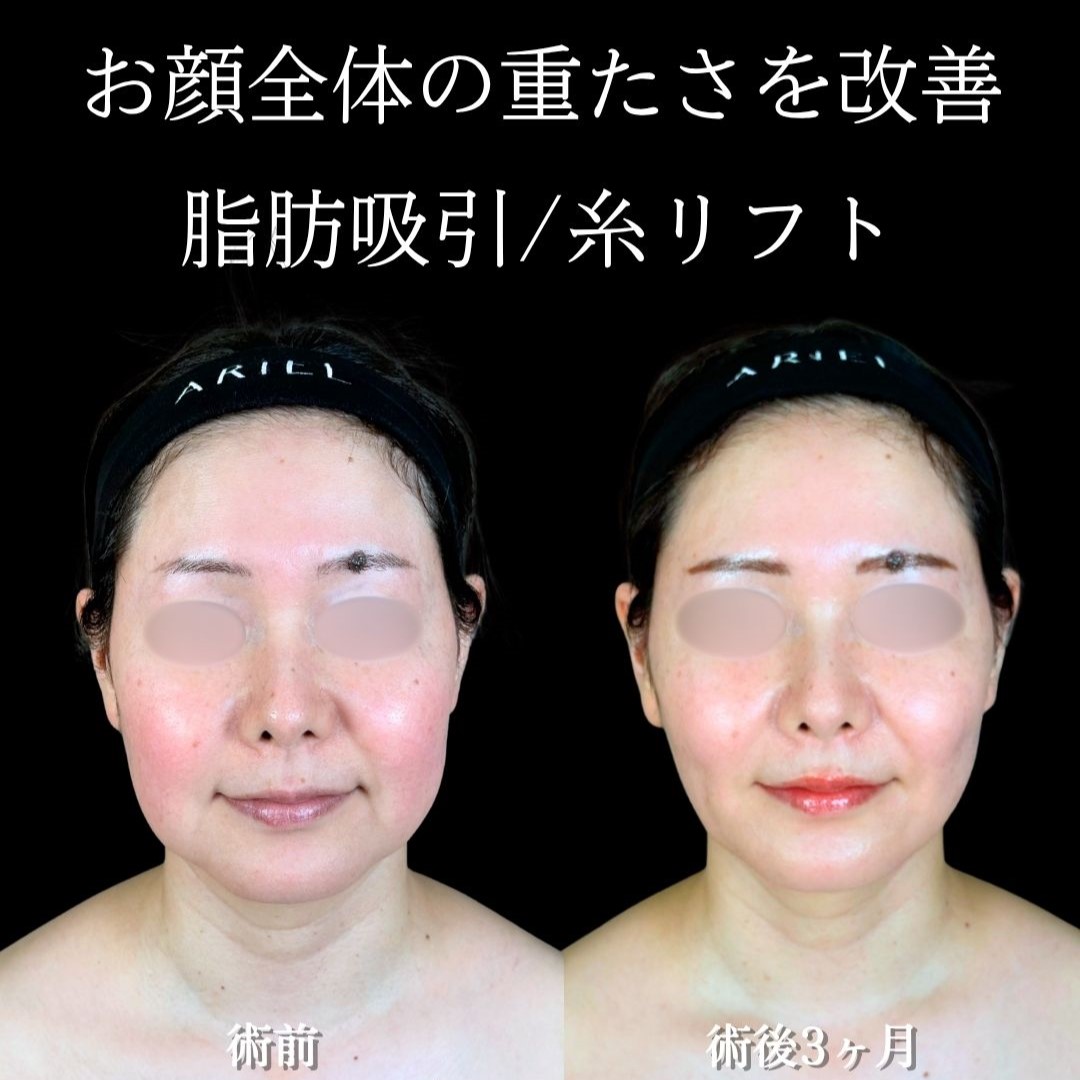 No.18414の症例写真