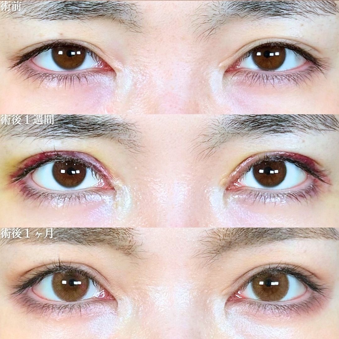 No.18440の症例写真