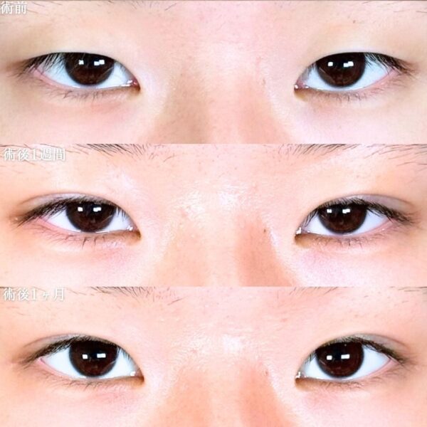 No.18037の症例写真
