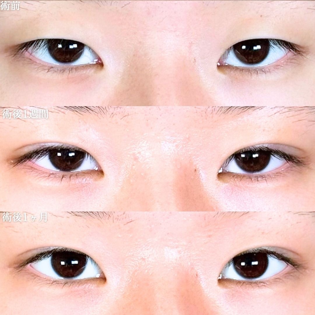 No.18037の症例写真 No.18037の症例写真