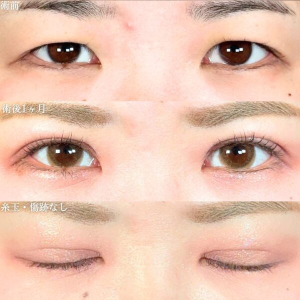 No.18112の症例写真