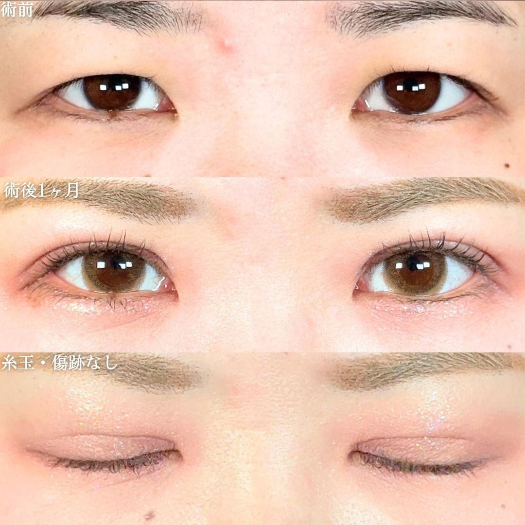 No.18112の症例写真 No.18112の症例写真