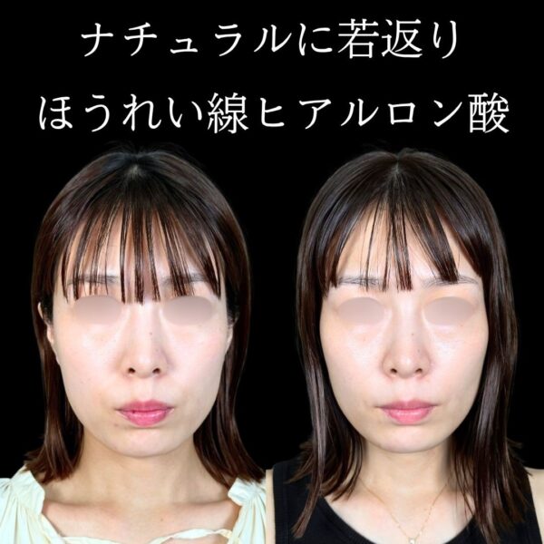 No.18199の症例写真