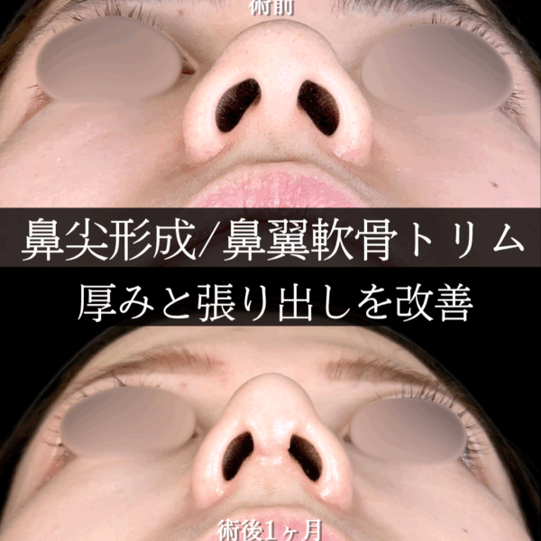 No.17942の症例写真