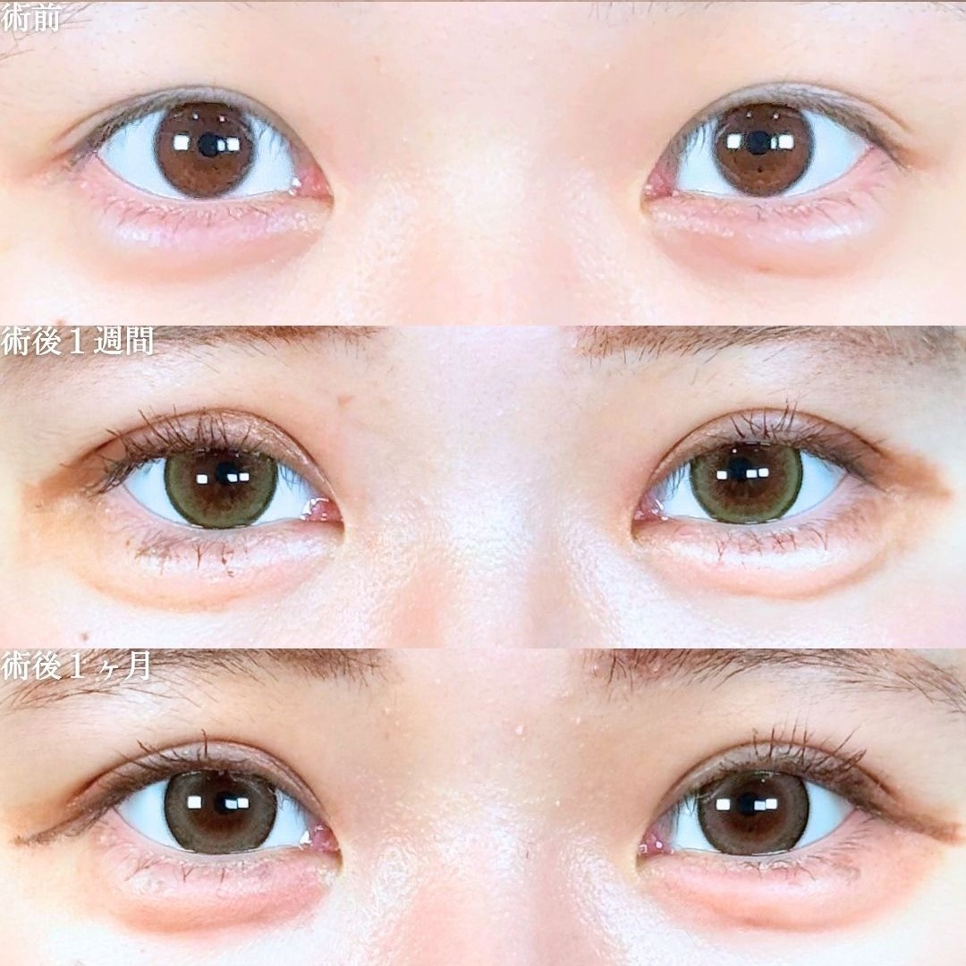 No.18219の症例写真 No.18219の症例写真