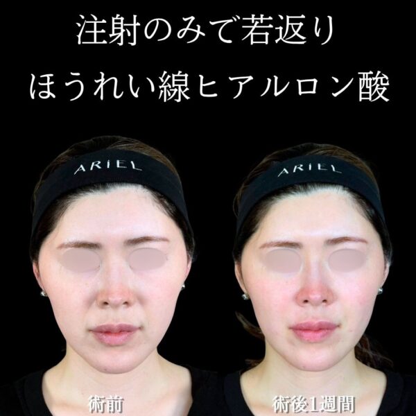 No.18291の症例写真 No.18291の症例写真