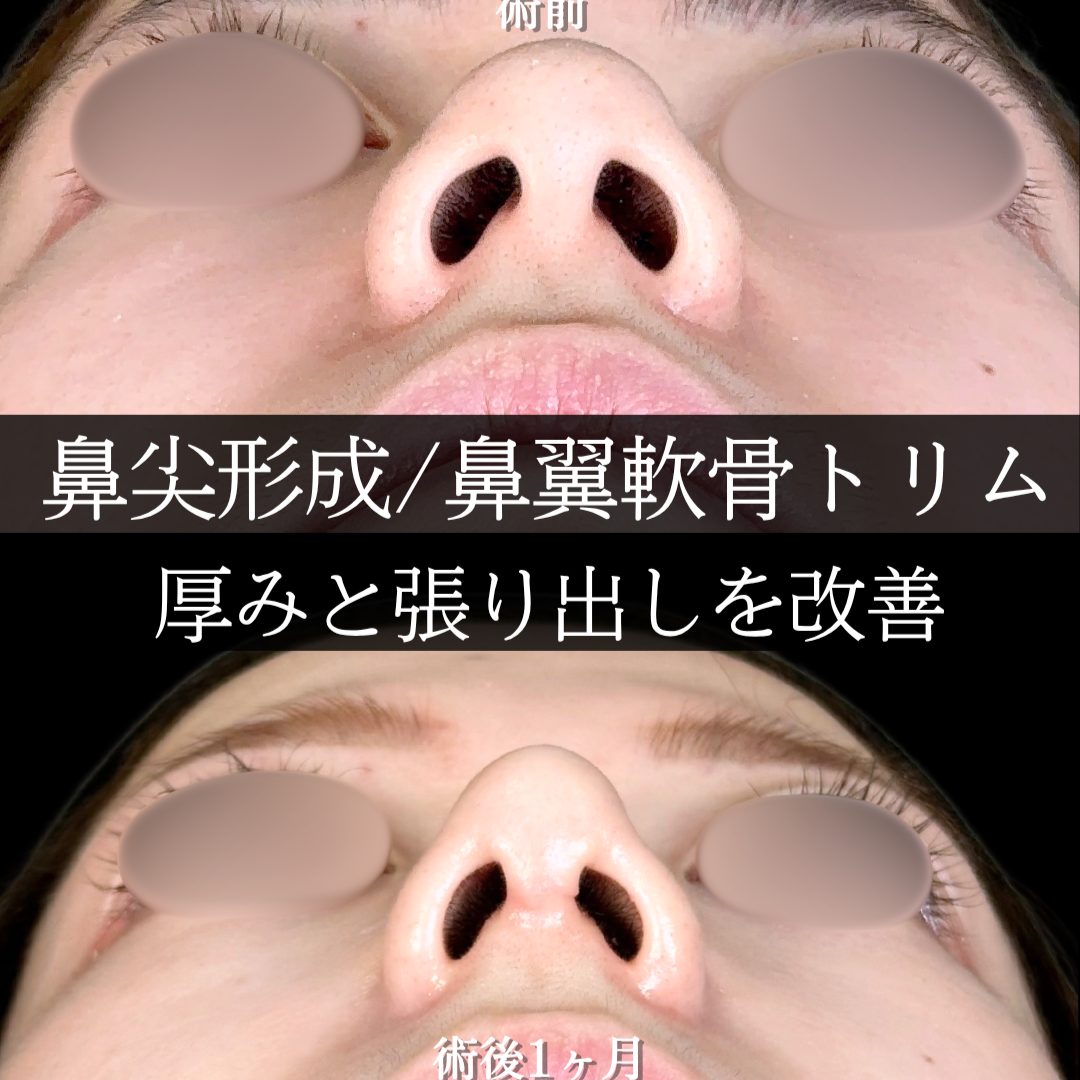 No.17942の症例写真 No.17942の症例写真