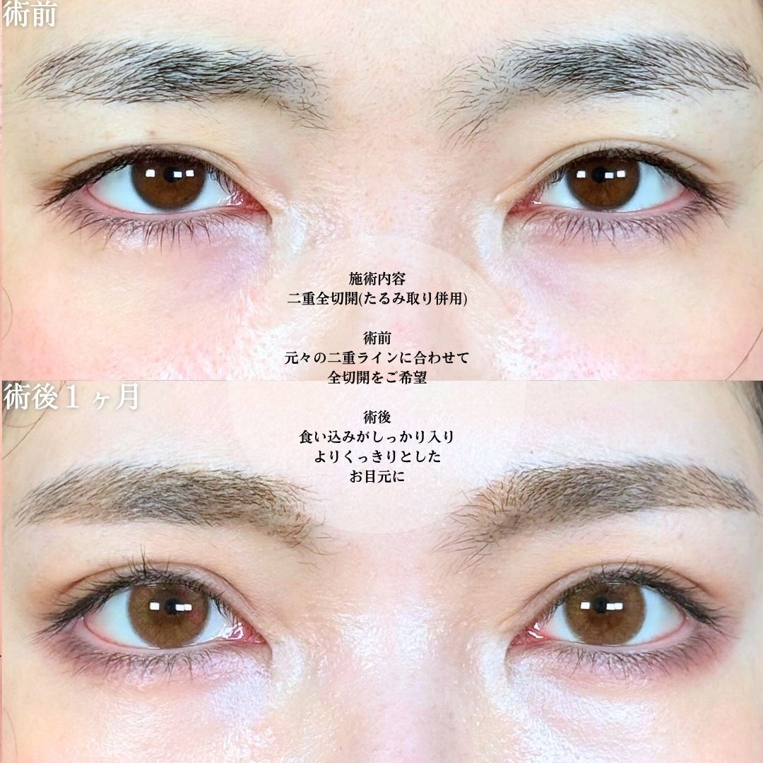 No.18440の症例写真1