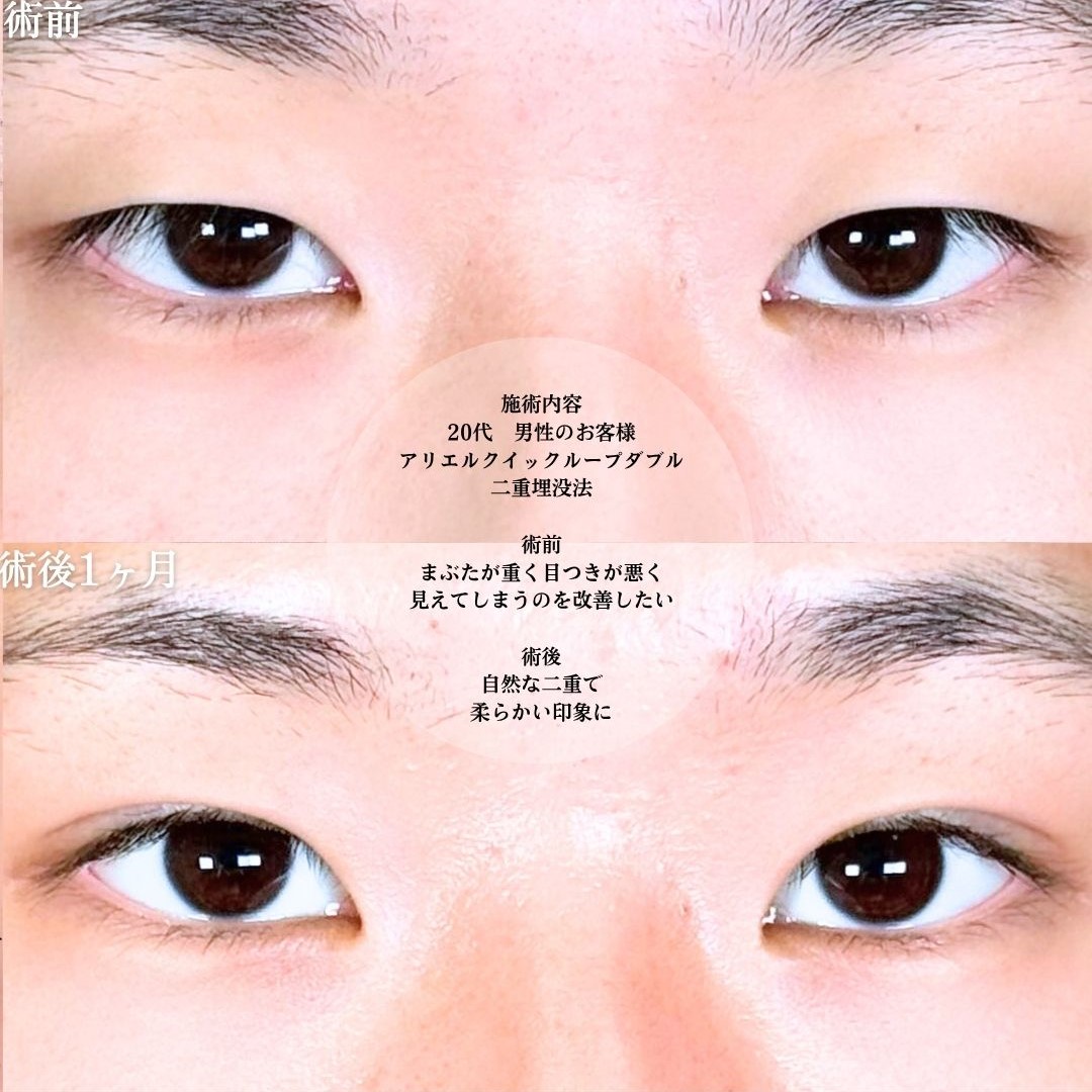 No.18037の症例写真1