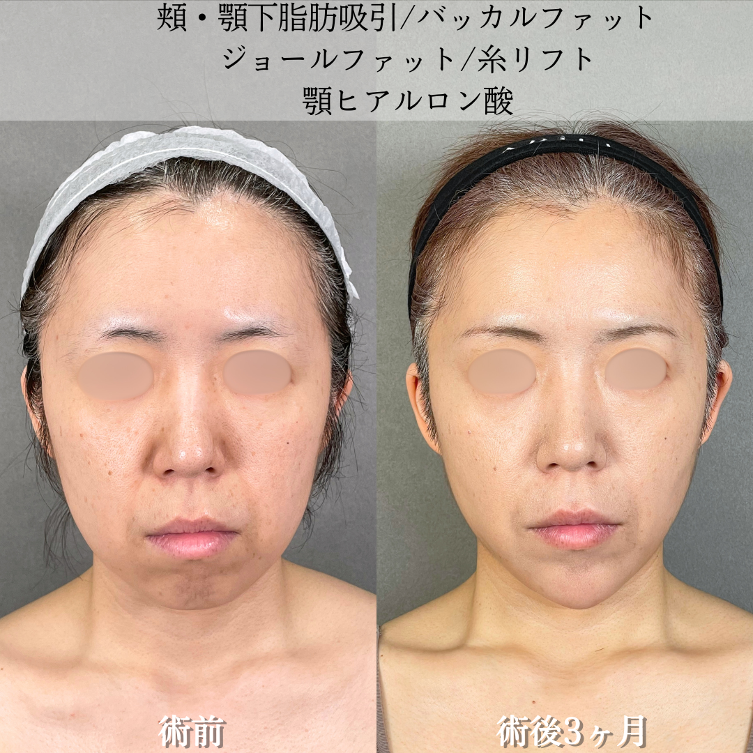 No.18026の症例写真2
