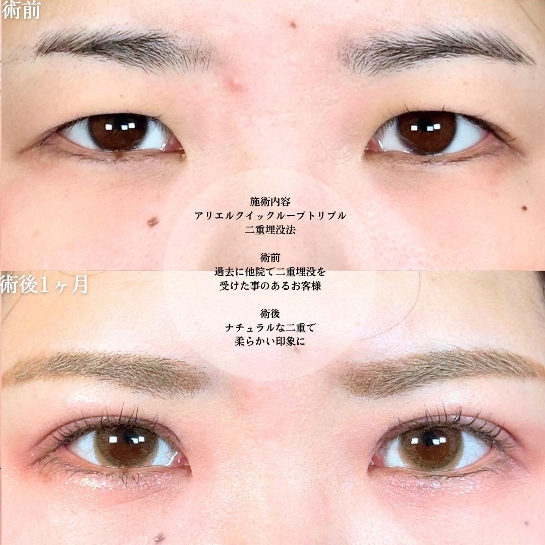 No.18112の症例写真1
