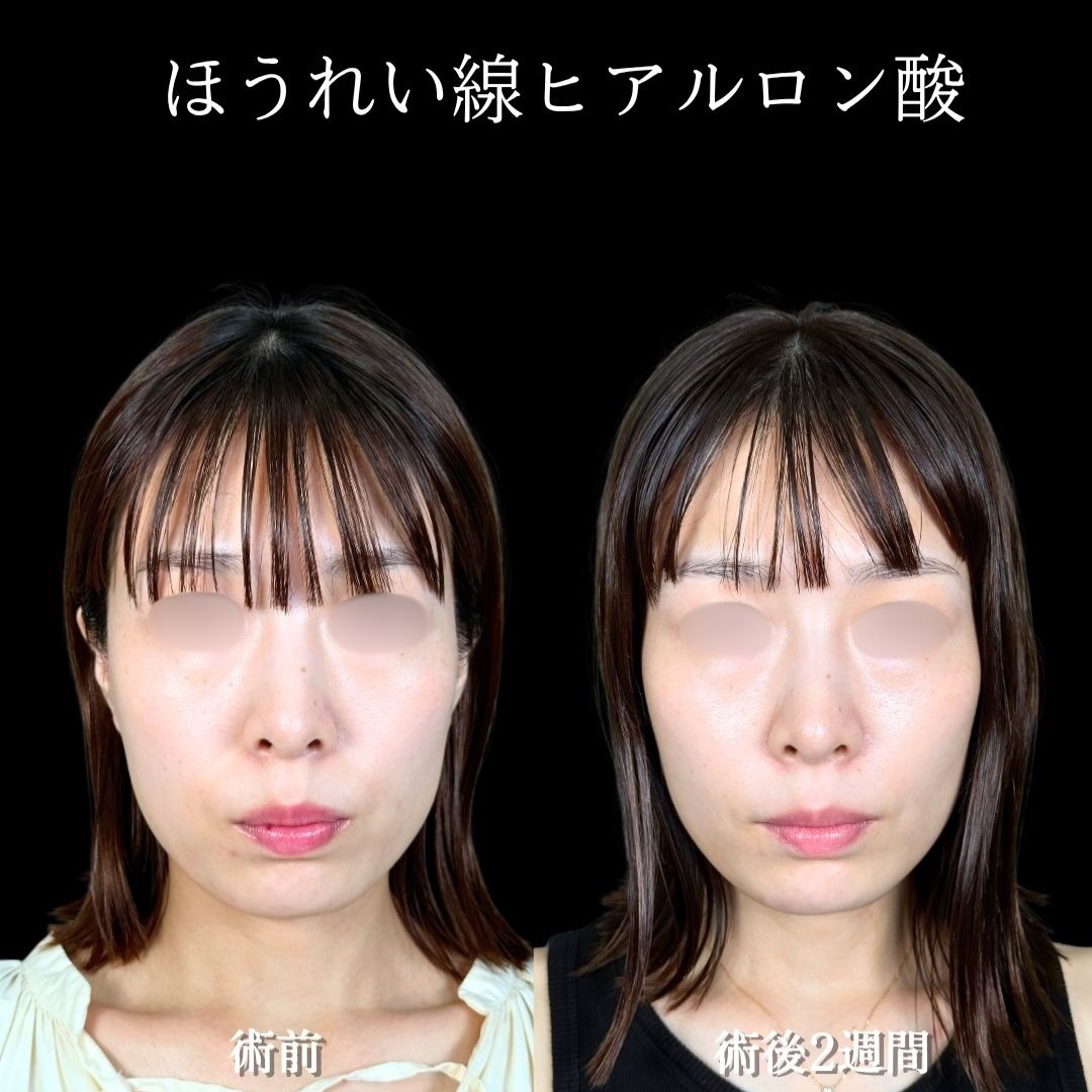 No.18199の症例写真2