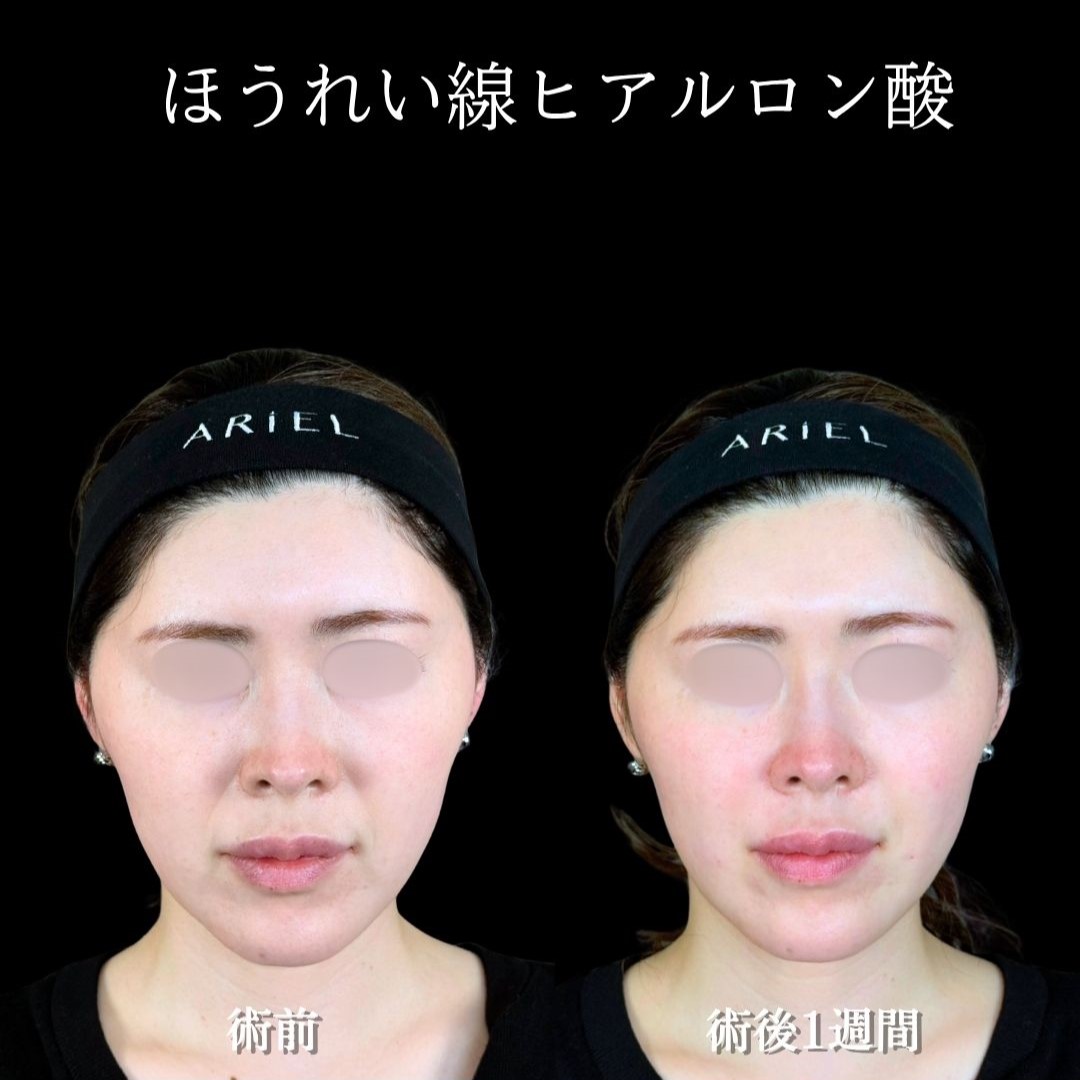 No.18291の症例写真2 No.18291の症例写真2