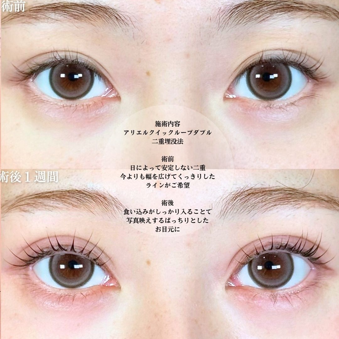 No.18301の症例写真1 No.18301の症例写真1